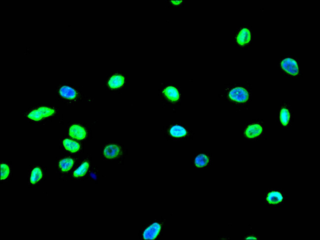 H3K18ac Antibody in Immunocytochemistry (ICC/IF)