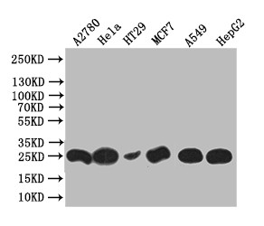 WFDC2 Antibody in Western Blot (WB)