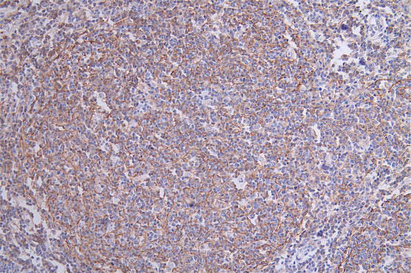 CD35 Antibody in Immunohistochemistry (Paraffin) (IHC (P))