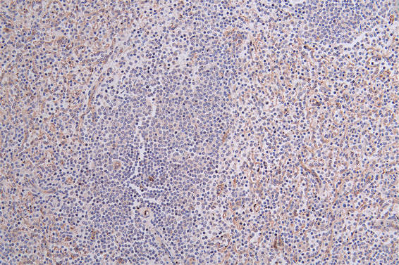 CD36 Antibody in Immunohistochemistry (Paraffin) (IHC (P))