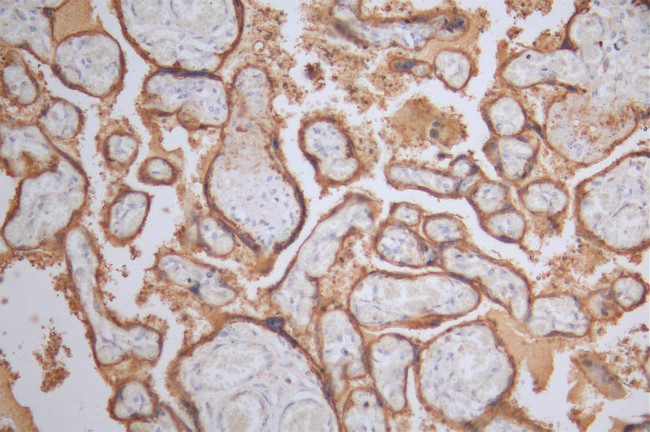 Placental Alkaline Phosphatase Antibody in Immunohistochemistry (Paraffin) (IHC (P))