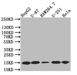 LC3B Antibody in Western Blot (WB)