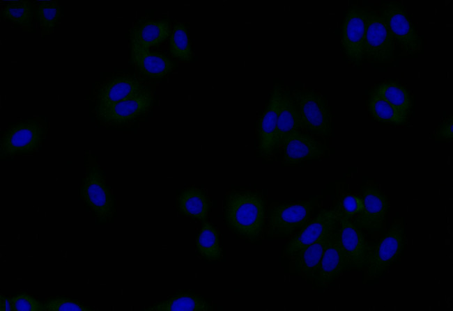 Gelsolin Antibody in Immunocytochemistry (ICC/IF)