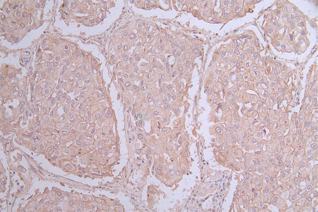 CD155 Antibody in Immunohistochemistry (Paraffin) (IHC (P))