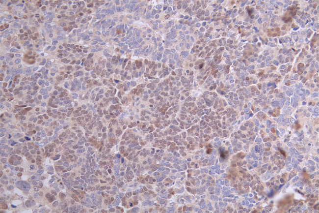 PAX8 Antibody in Immunohistochemistry (Paraffin) (IHC (P))