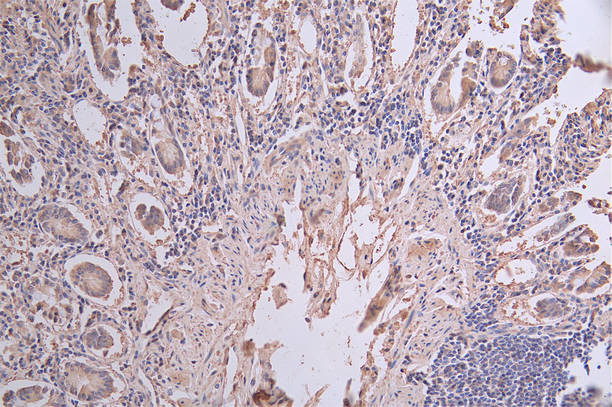 Cytokeratin 20 Antibody in Immunohistochemistry (Paraffin) (IHC (P))