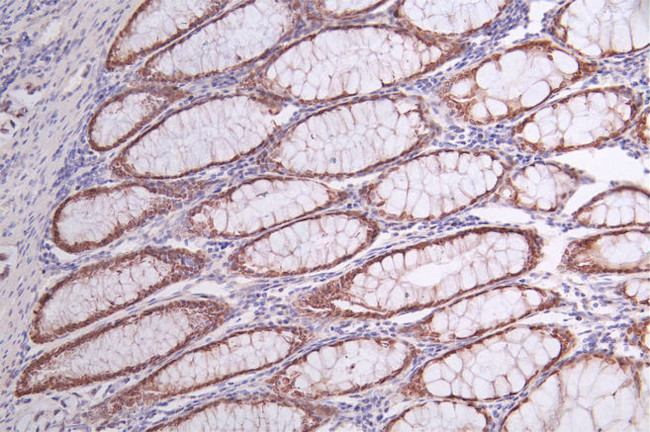 SATB2 Antibody in Immunohistochemistry (Paraffin) (IHC (P))