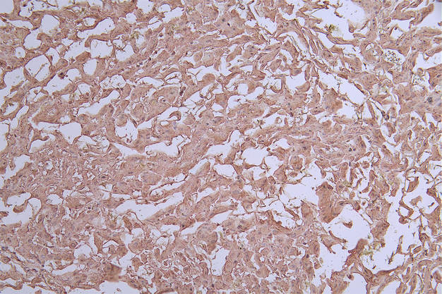 Arginase 1 Antibody in Immunohistochemistry (Paraffin) (IHC (P))
