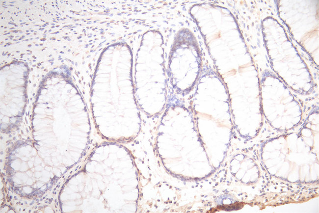 Podoplanin Antibody in Immunohistochemistry (Paraffin) (IHC (P))