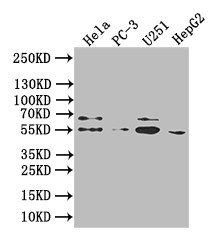 GIPR Antibody in Western Blot (WB)