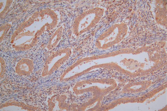 PRDX2 Antibody in Immunohistochemistry (Paraffin) (IHC (P))