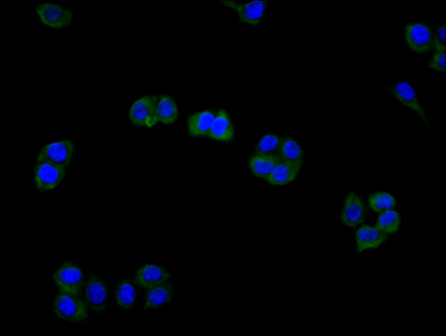 AXL Antibody in Immunocytochemistry (ICC/IF)