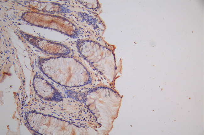CRMP2 Antibody in Immunohistochemistry (Paraffin) (IHC (P))