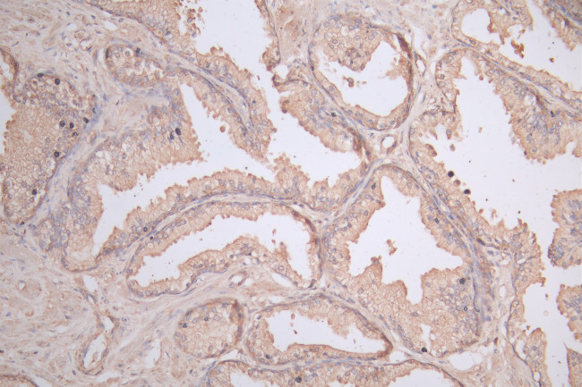 COL1A2 Antibody in Immunohistochemistry (Paraffin) (IHC (P))