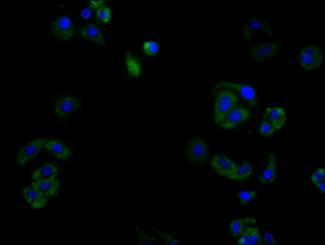 CD138 Antibody in Immunocytochemistry (ICC/IF)