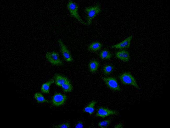 TIM-3 Antibody in Immunocytochemistry (ICC/IF)