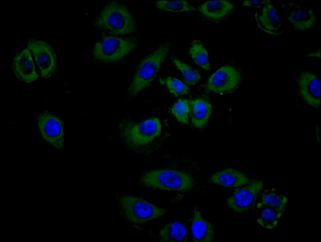 CSF2RB Antibody in Immunocytochemistry (ICC/IF)