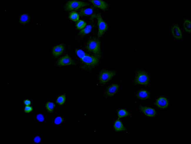 TRAIL-R2 (DR5) Antibody in Immunocytochemistry (ICC/IF)