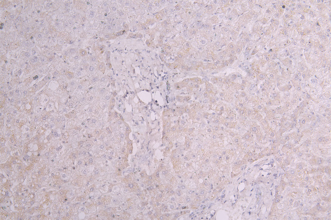 C1S Antibody in Immunohistochemistry (Paraffin) (IHC (P))