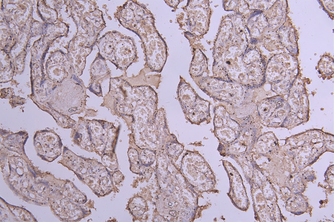 CD39 Antibody in Immunohistochemistry (Paraffin) (IHC (P))