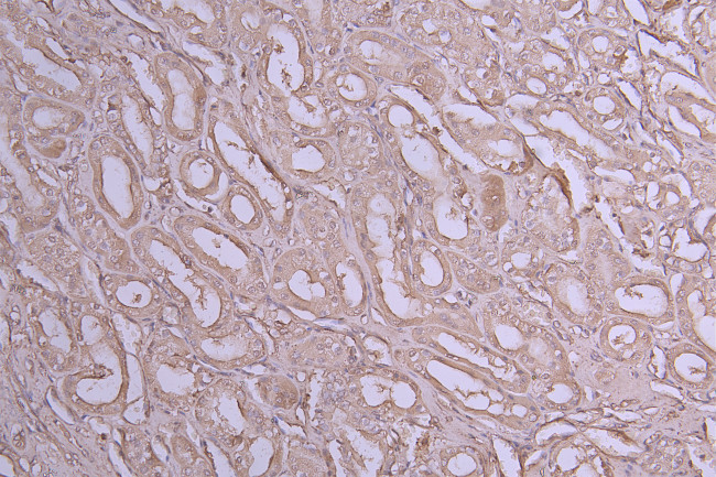 IL-1 beta Antibody in Immunohistochemistry (Paraffin) (IHC (P))