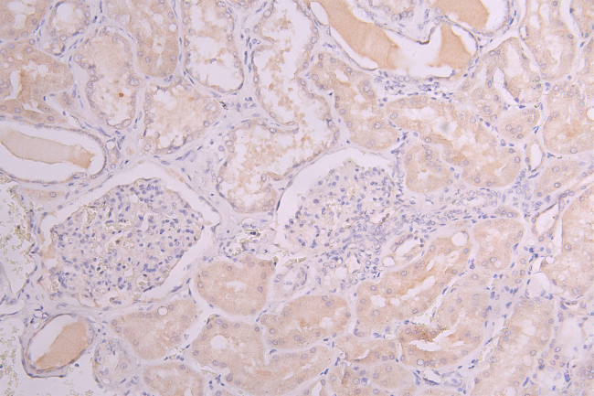 HGF Antibody in Immunohistochemistry (Paraffin) (IHC (P))