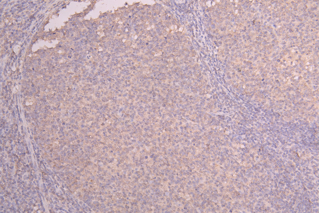 IL-22 Antibody in Immunohistochemistry (Paraffin) (IHC (P))