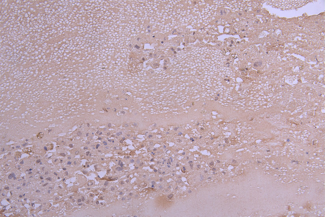 MCP-1 Antibody in Immunohistochemistry (Paraffin) (IHC (P))