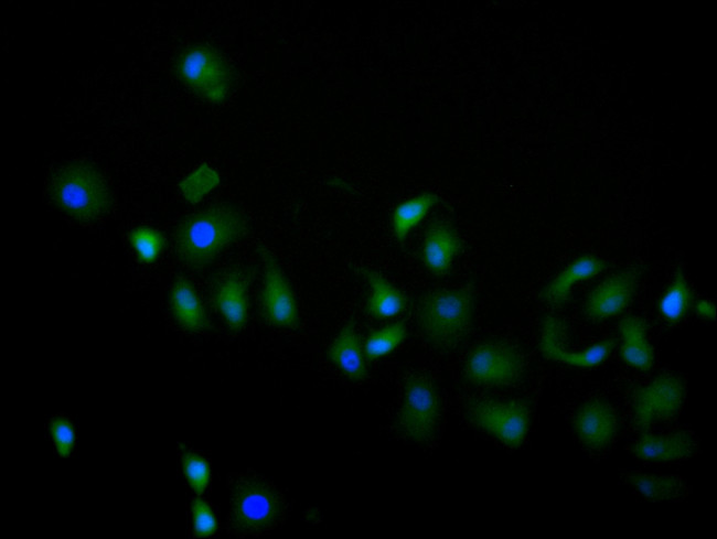 MIF Antibody in Immunocytochemistry (ICC/IF)