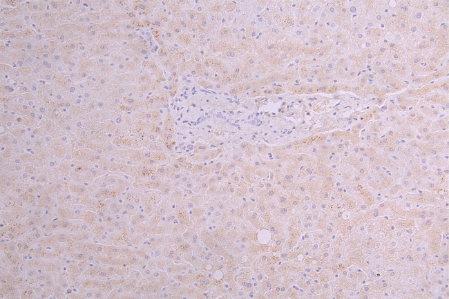 TSLP Antibody in Immunohistochemistry (Paraffin) (IHC (P))