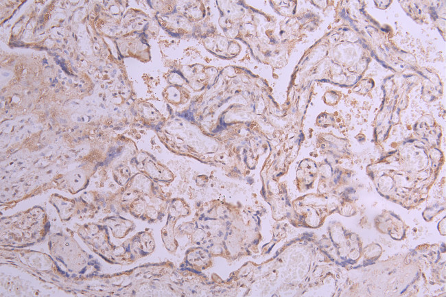 ITGA5 Antibody in Immunohistochemistry (Paraffin) (IHC (P))