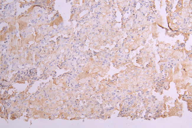 KIR2DL1 Antibody in Immunohistochemistry (Paraffin) (IHC (P))