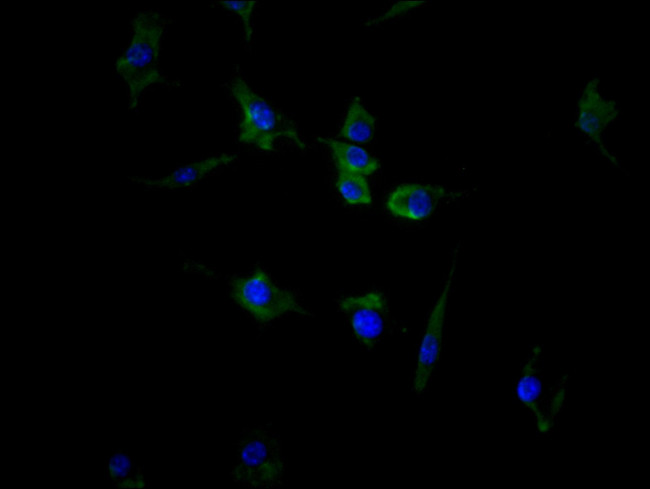 ACVR2B Antibody in Immunocytochemistry (ICC/IF)