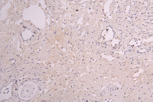 CSF3R Antibody in Immunohistochemistry (Paraffin) (IHC (P))
