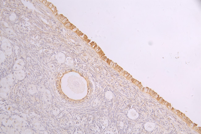 ROR2 Antibody in Immunohistochemistry (Paraffin) (IHC (P))