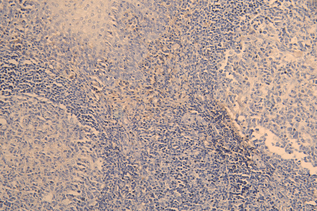 OX40 Antibody in Immunohistochemistry (Paraffin) (IHC (P))