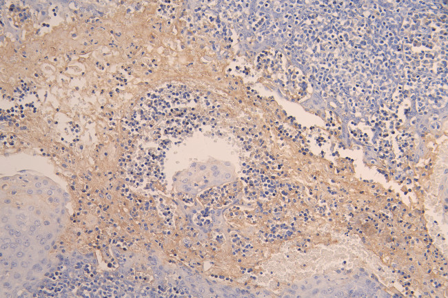 CD37 Antibody in Immunohistochemistry (Paraffin) (IHC (P))