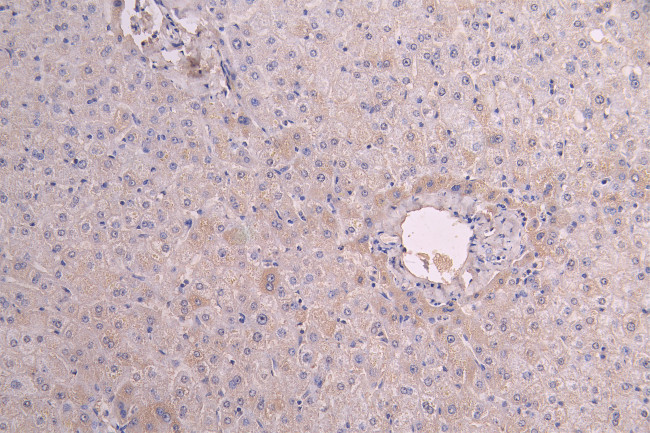 IL13RA1 Antibody in Immunohistochemistry (Paraffin) (IHC (P))