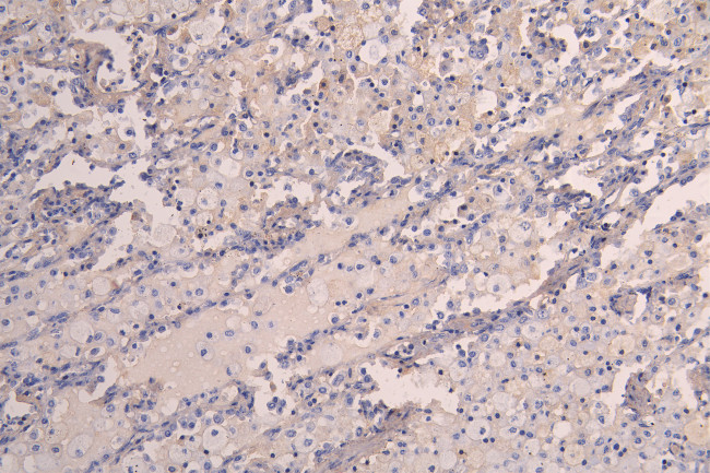 VEGF Receptor 2 Antibody in Immunohistochemistry (Paraffin) (IHC (P))