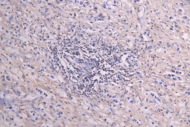 GREM1 Antibody in Immunohistochemistry (Paraffin) (IHC (P))