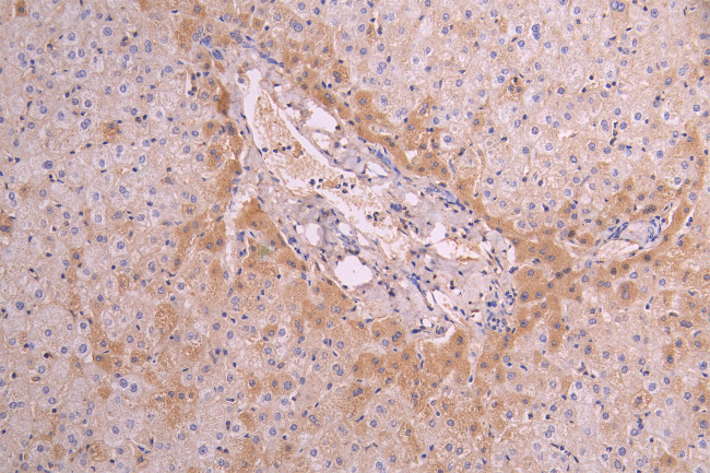 CD14 Antibody in Immunohistochemistry (Paraffin) (IHC (P))