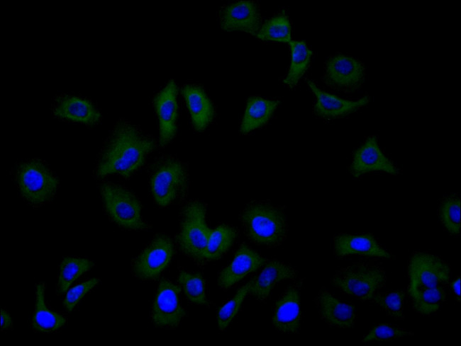 ASCT2 Antibody in Immunocytochemistry (ICC/IF)