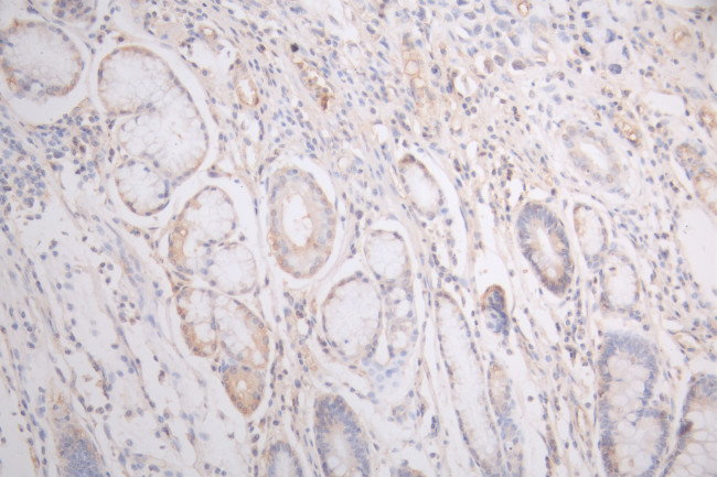 VEGF Receptor 1 Antibody in Immunohistochemistry (Paraffin) (IHC (P))