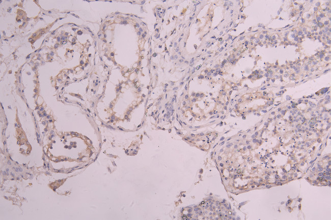 c-Kit Antibody in Immunohistochemistry (Paraffin) (IHC (P))