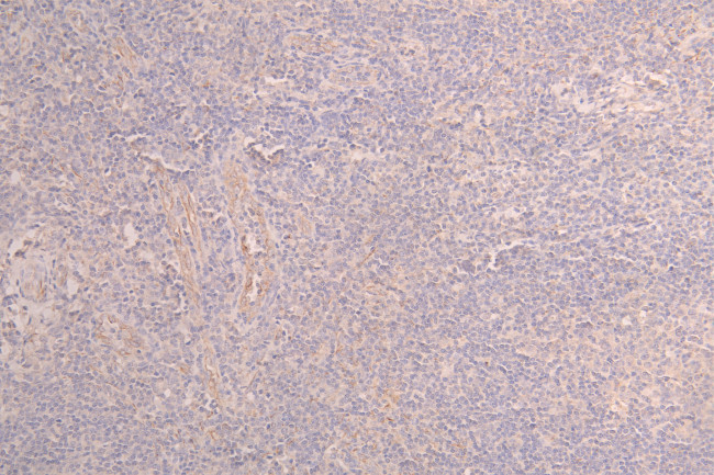 CD223 Antibody in Immunohistochemistry (Paraffin) (IHC (P))