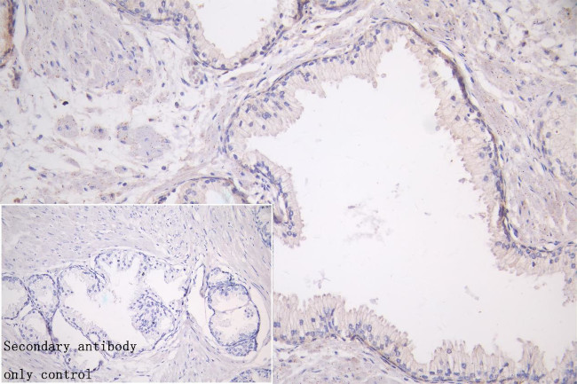 LRP1 Antibody in Immunohistochemistry (Paraffin) (IHC (P))