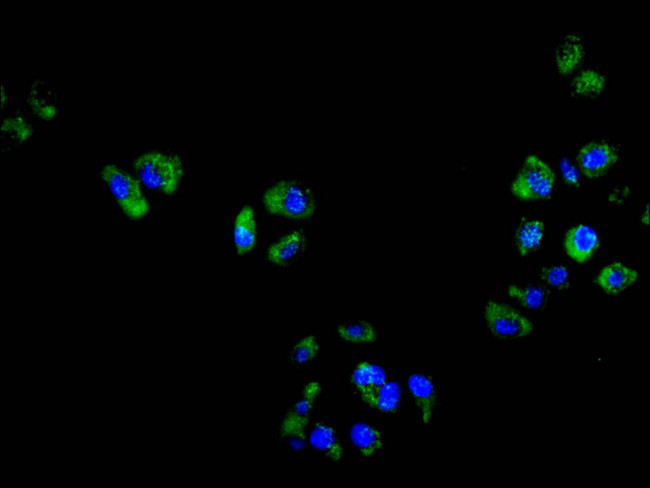 NOX2 Antibody in Immunocytochemistry (ICC/IF)