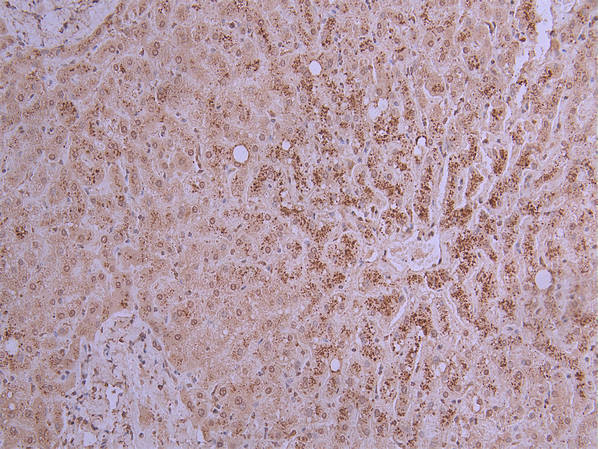 PCSK9 Antibody in Immunohistochemistry (Paraffin) (IHC (P))