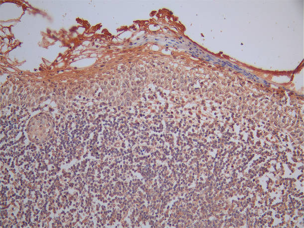 Granzyme B Antibody in Immunohistochemistry (Paraffin) (IHC (P))