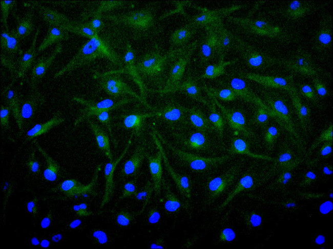 FGF1 Antibody in Immunocytochemistry (ICC/IF)